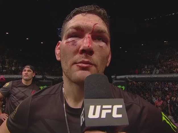 Screenshot credits to @ZProphet_MMA on Twitter. ufc 194 weidman injured face vs rockhold