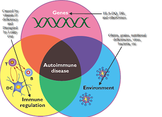 the etiology signs and symptoms diagnostics management and prognosis of autoimmune disease Get an overview of crohn’s disease, including symptoms, how it differs from ulcerative colitis and the factors that may cause the disease. the etiology signs and symptoms diagnostics management and prognosis of autoimmune disease Get an overview of crohn’s disease, including symptoms, how it differs from ulcerative colitis and the factors that may cause the disease.