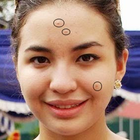 Menghilangkan Jerawat Dengan Photoshop Menghilangkan Jerawat Dengan Photoshop