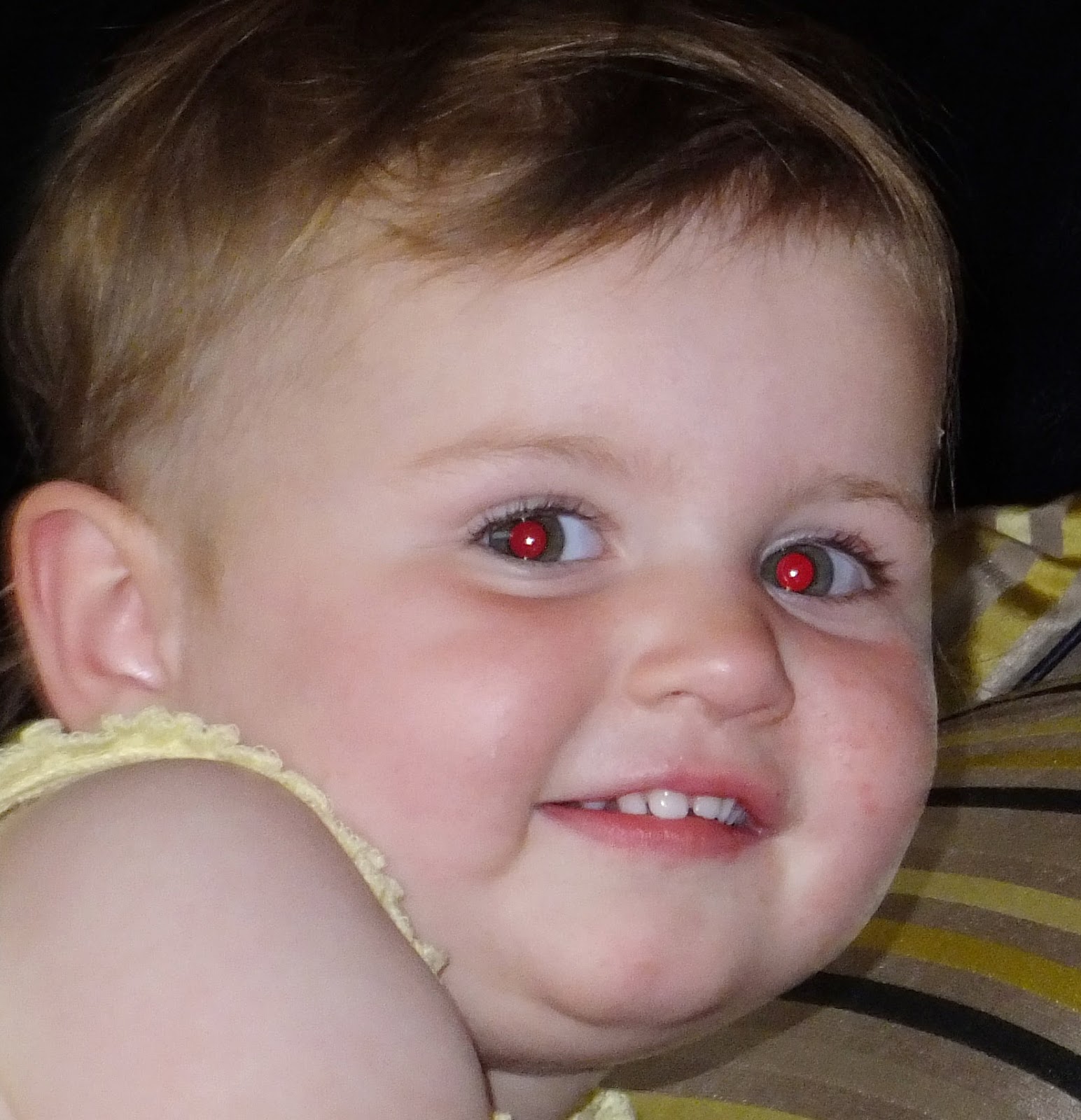 Red Eyes Pupil at Dianne Porter blog