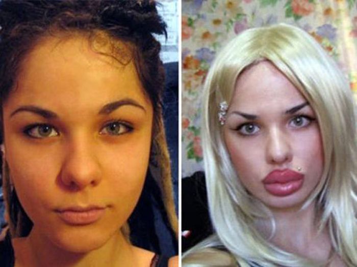 plastic surgeries Plastic surgery news find breaking news, commentary, and archival information about plastic surgery from the latimes. plastic surgeries Plastic surgery news find breaking news, commentary, and archival information about plastic surgery from the latimes.