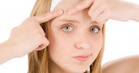 Dunia Vitaminku: Cara menghilangkan "BLACKHEAD" dan "WHITEHEAD" dengan vitamin semulajadi Dunia Vitaminku: Cara menghilangkan "BLACKHEAD" dan "WHITEHEAD" dengan vitamin semulajadi