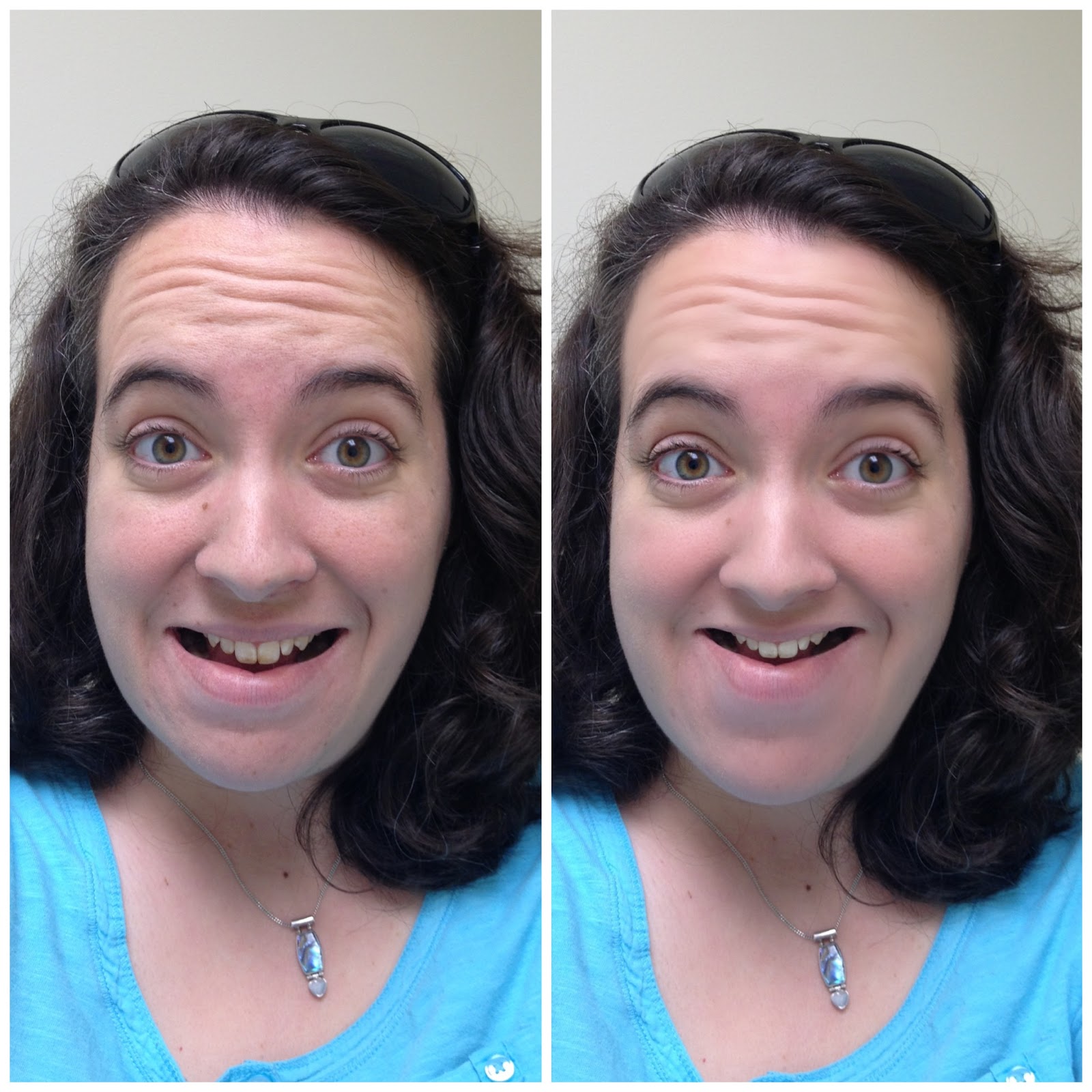 List 103+ Pictures Why Does My Face Look Asymmetrical In Pictures Updated