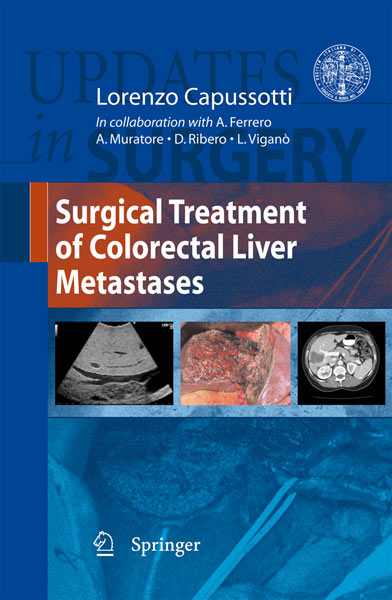 Treatment of Colorectal Liver Metastases