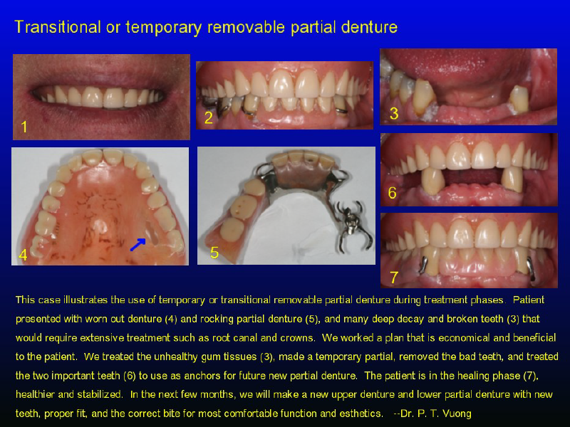 Dr. Phuoc Vuong Dentist Phuoc T. Vuong, DMD, MS Dr. Phil T. Vuong