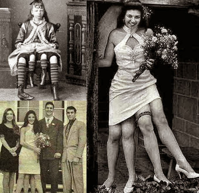 All About Me & Photography ^^ UNIQUE (Girl With 4 Legs)