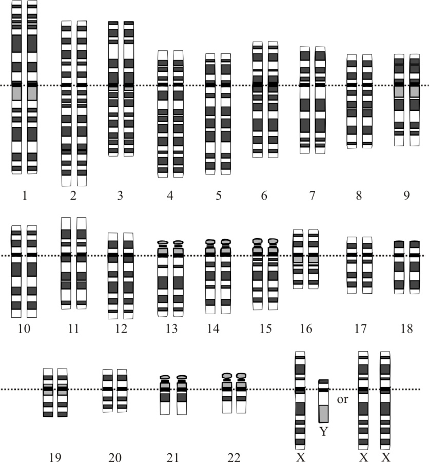 Caryotype Humain