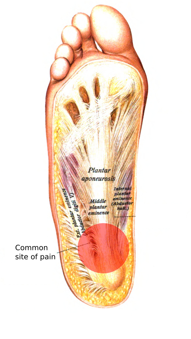 Ideal Balance Center for Sports Medicine Acupuncture Ideal Balance Center for Sports Medicine Acupuncture