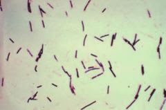 Vi khuẩn Clostridium perfringens. Nguồn:Wikipedia