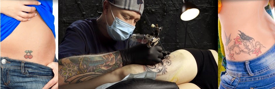 Best Laser Tattoo Removal in Vancouver BC
