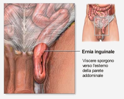 Mal di schiena sopra una scapola sinistra