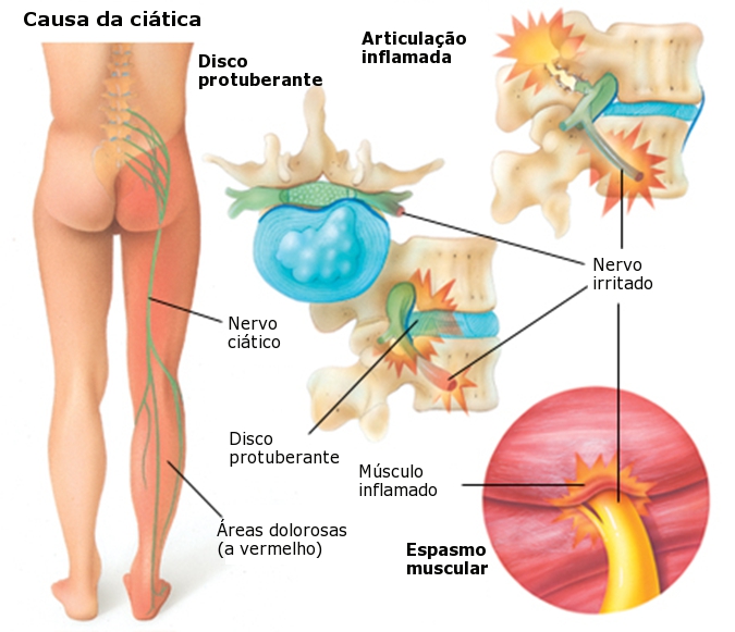 Deterioração em um tratamento de potência