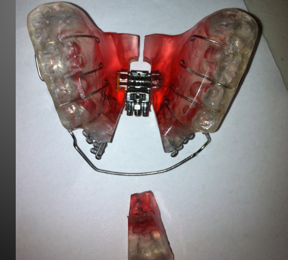 My new DNA Appliance