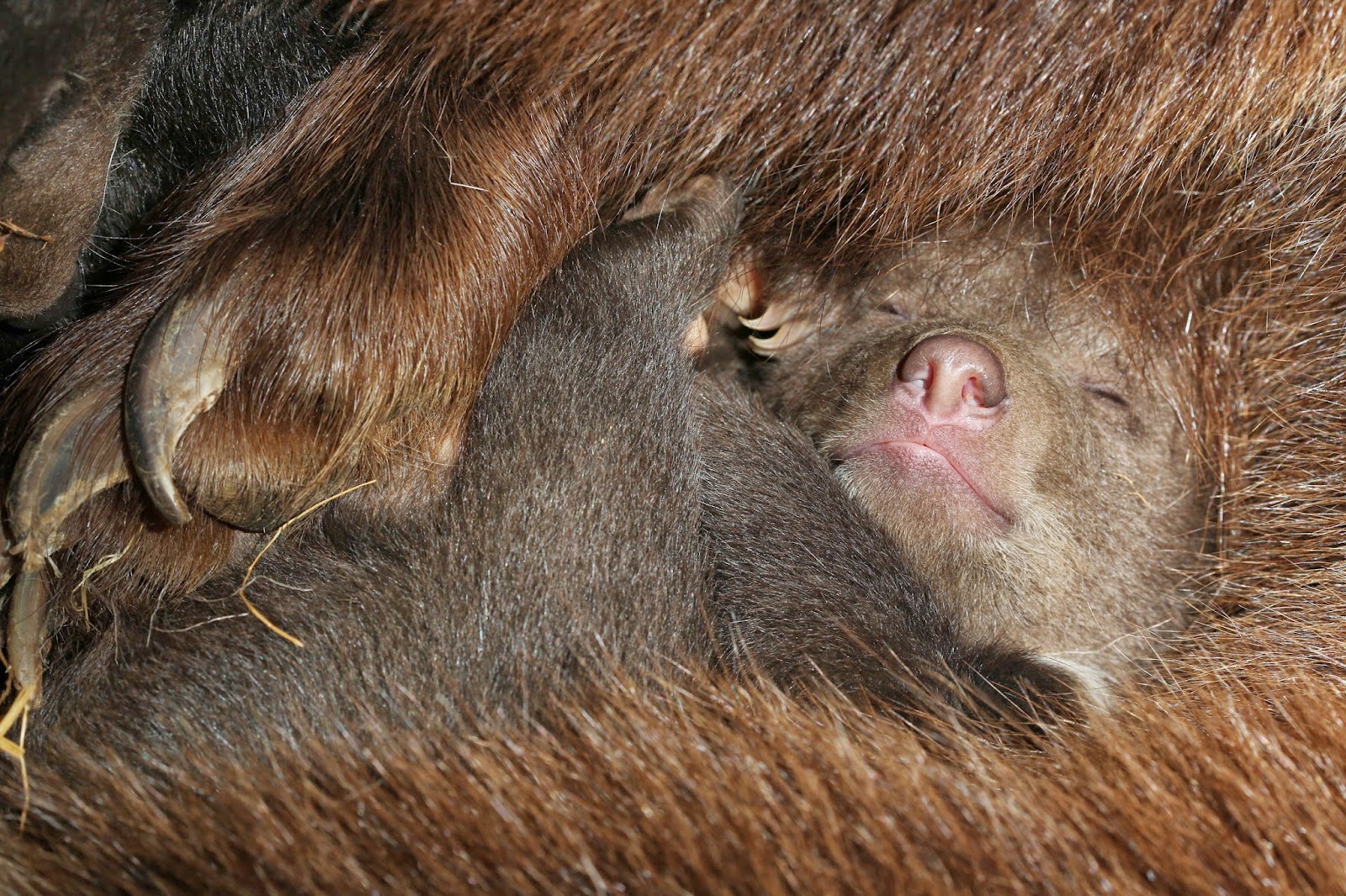 Class 2 Device Recall JVAC Bulb Suction Reservoir