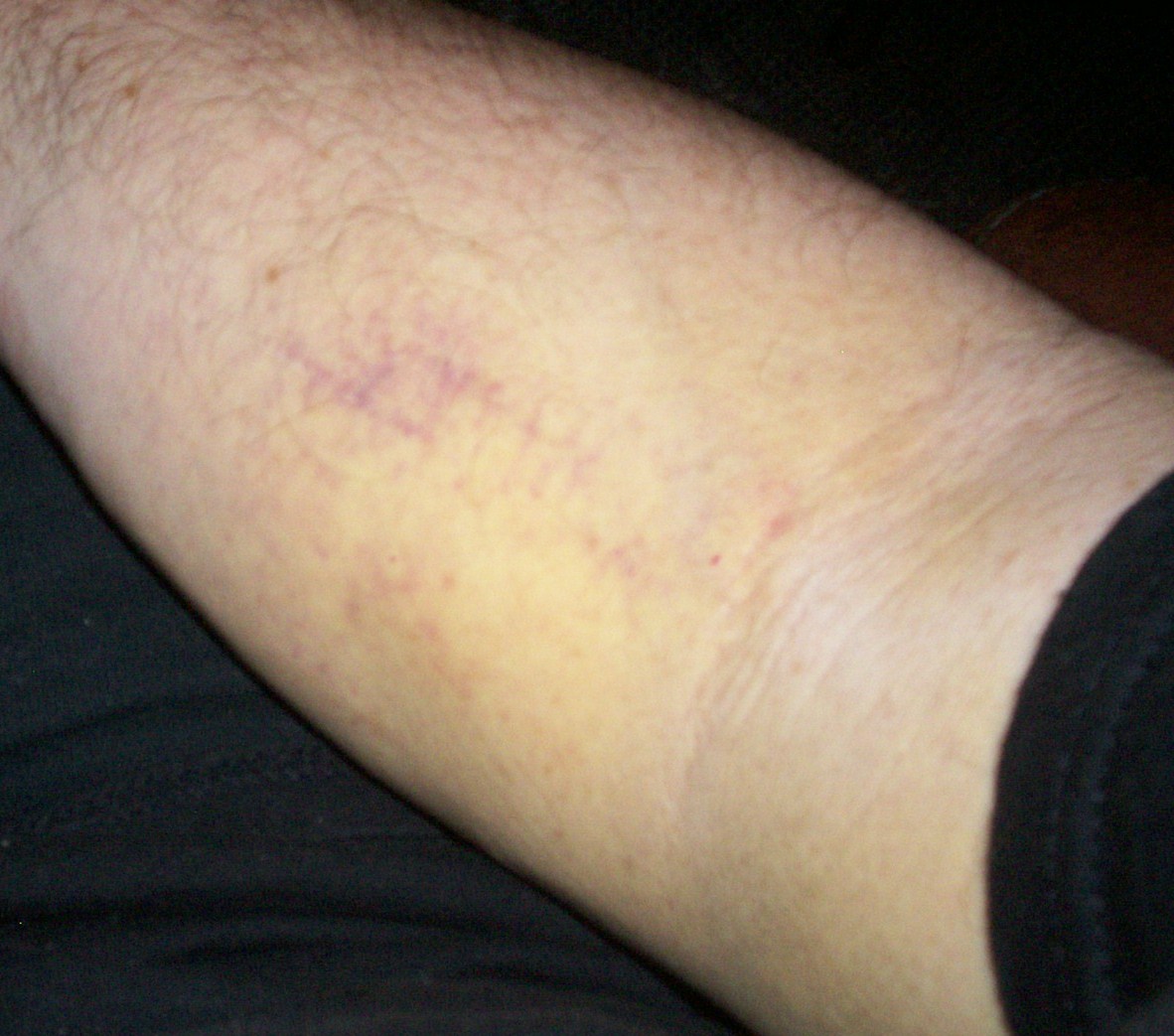 In Purple I'm Stunning 2.0 June 2011