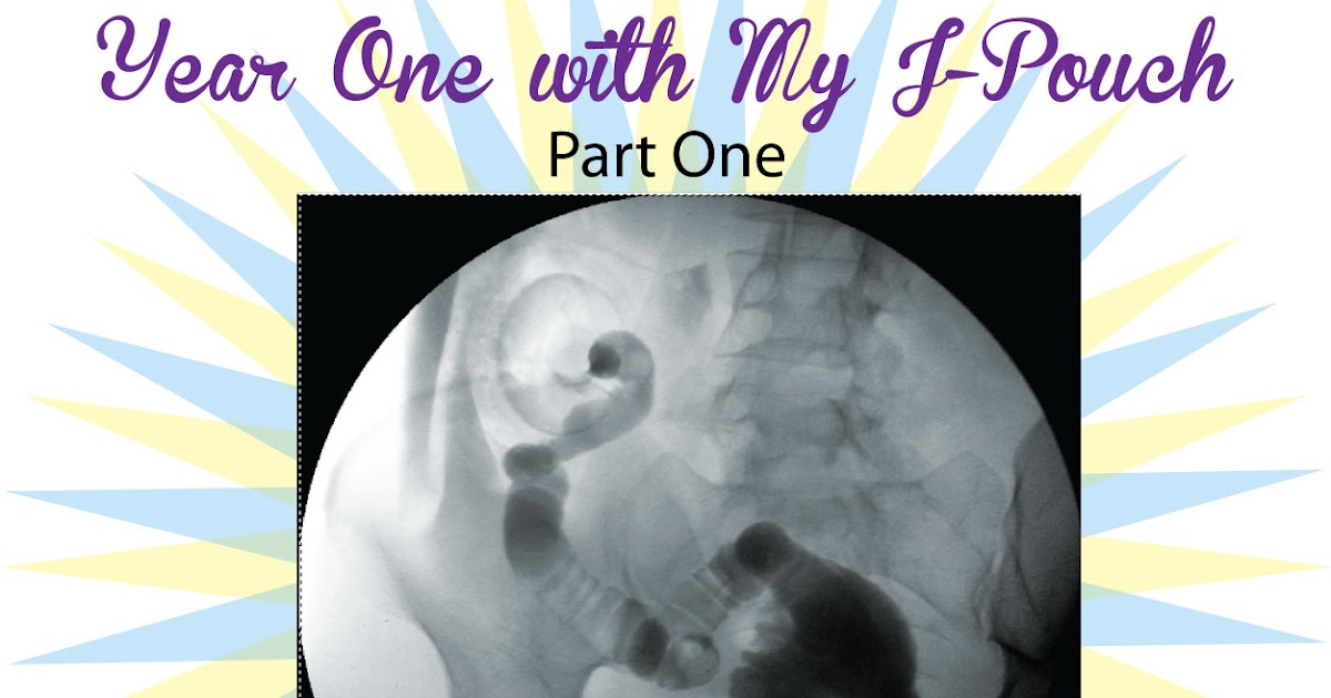 Colitis Ninja® Year One with My JPouch Part One