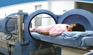 India. Monoplace Hyperbaric Oxygen Therapy Chamber .