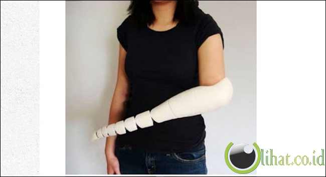 Lengan Tentakel Lengan Tentakel