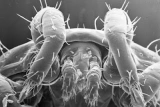 dust-mite-body-hair.