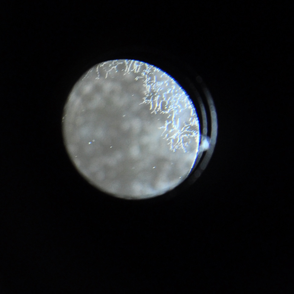 Fungus in lens the new blogger