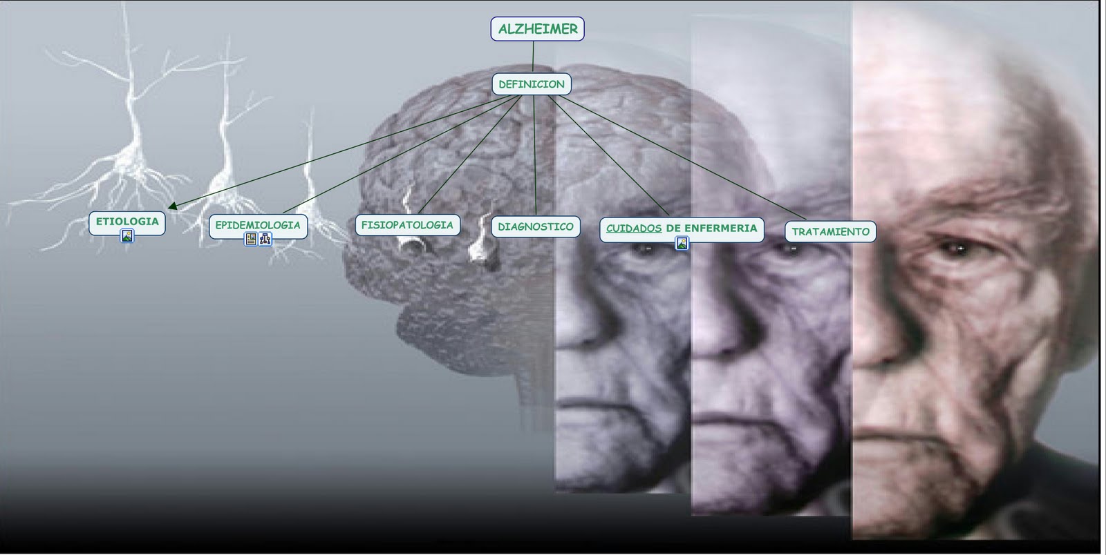 Cuidado de Enfermeria al Adulto y a la Familia I ENFERMEDAD DE ALZHEIMER