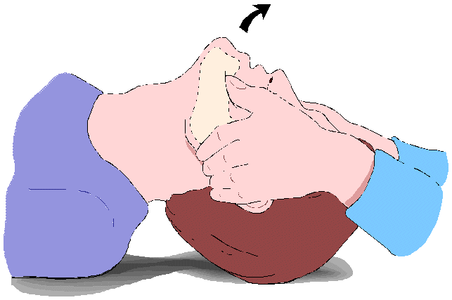 Las operaciones y el tratamiento de la columna vertebral