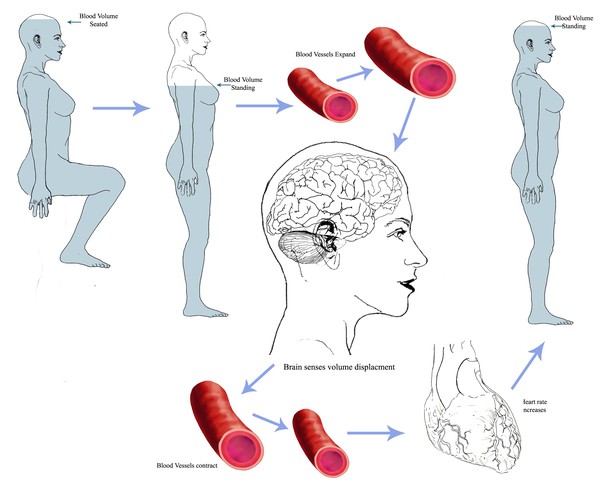dysautonomia pots
