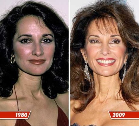 susan lucci breast augmentation Asian porn movie clip
