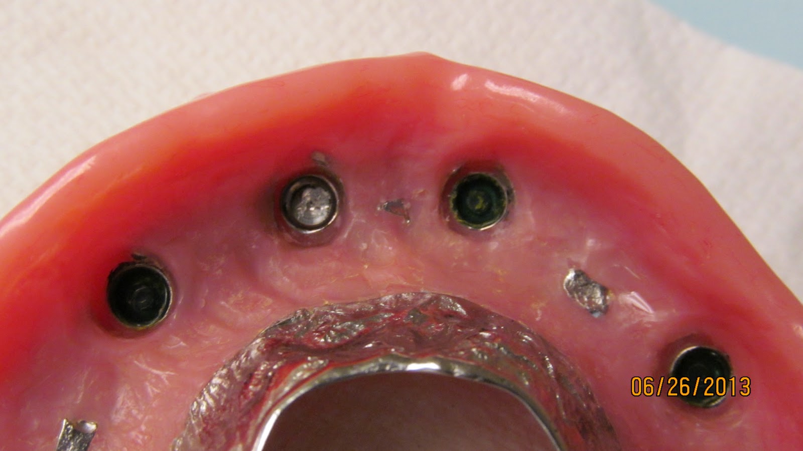 Dental Clinical Case Presentations StepbyStep guides Changing