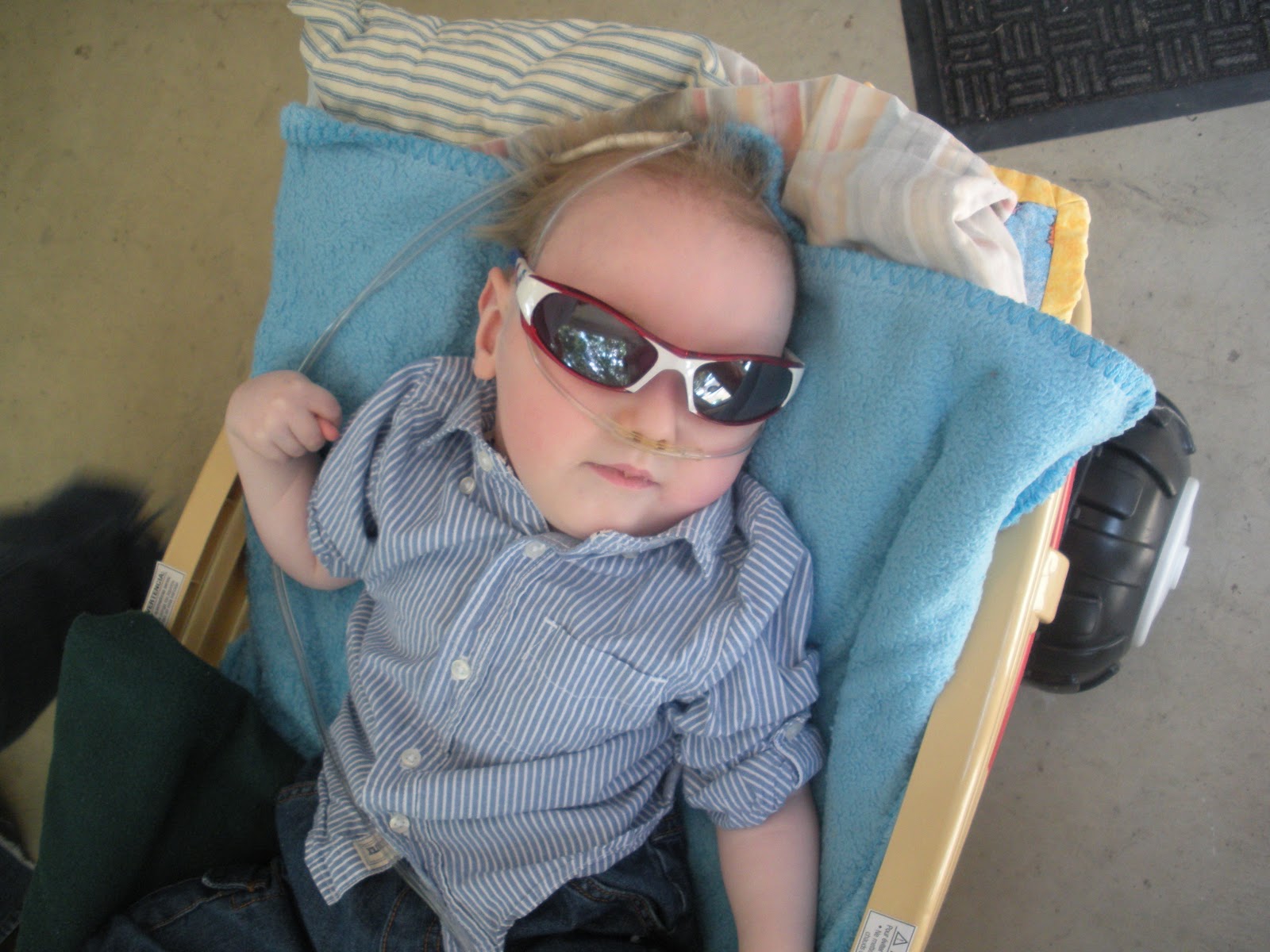 Natural Skin Care Menkes Syndrome Html In Hitizexyt Github Com