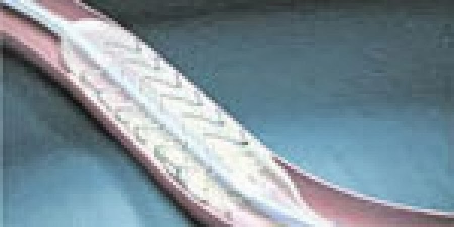 القسطرة لتوسيع الشرايين بدون جراحة Youtube