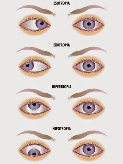 A máscara da pele em volta de olhos como pôr