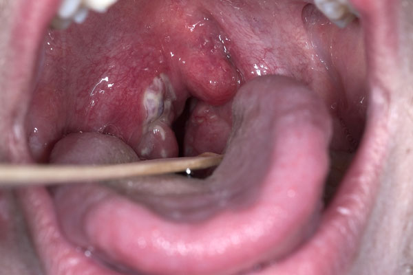 How To Treat Post Nasal Drip In Dogs How To Treat Post Nasal Drip In Dogs