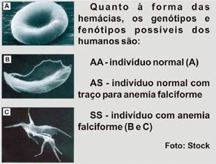 Qual exame que detecta anemia