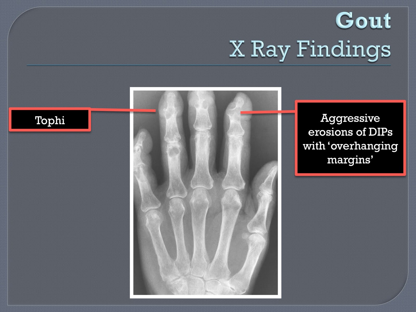 Struggling HO Xray for Ortho