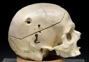 skull with gunshoot hole