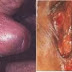 Harga Obat Sifilis thumbnail