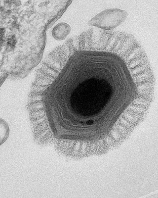 智利發現 百萬病毒 最大病毒 Megavirus chilensis