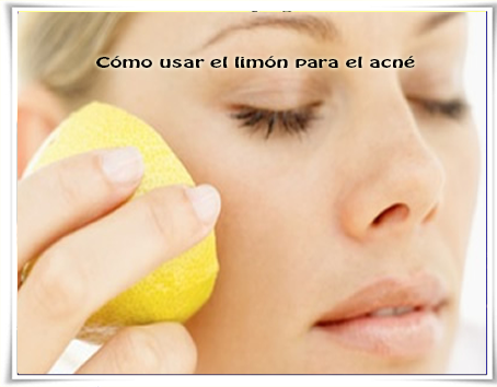 Cómo usar el limón para el acné Belleza facial, cuidados del rostro, acnè, limòn