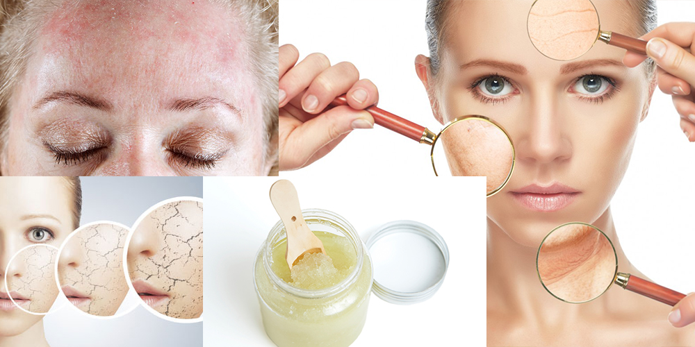 Home Remedies for Dry Skin for Winter Life With Styles