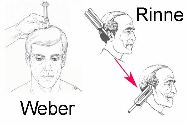 weber tuning fork weber tuning fork