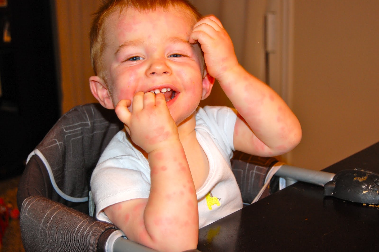 The Pattersons Deacon's weird disease.