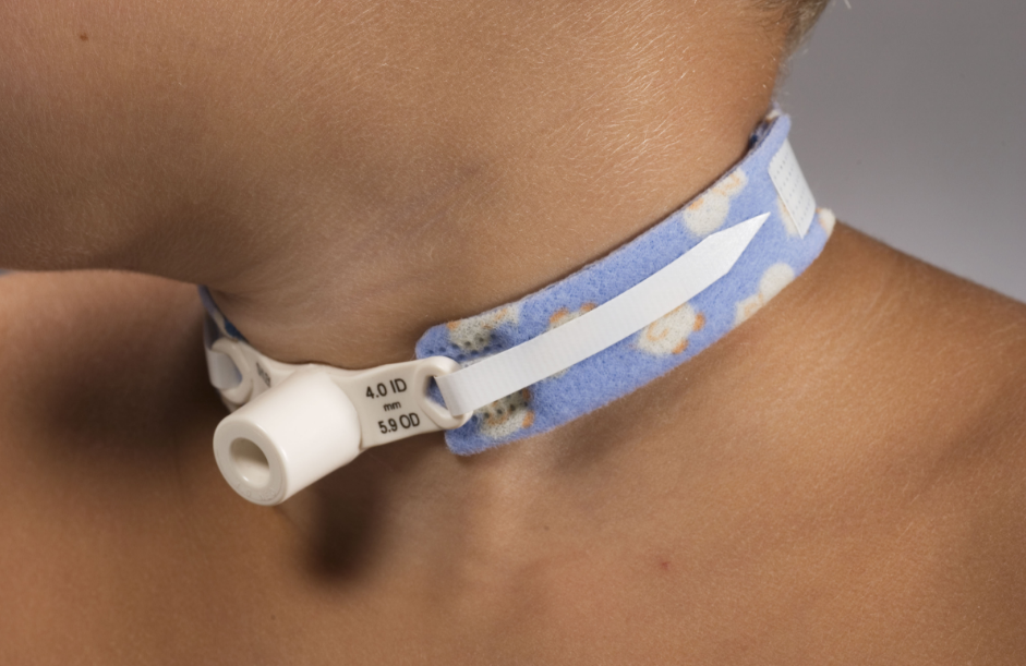 Classificação das Traqueostomias Faça Fisioterapia