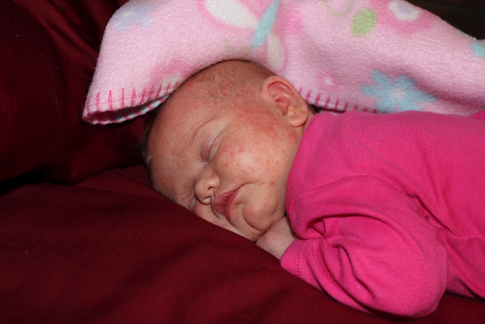 Beautiful Life Cradle Cap Stinks!