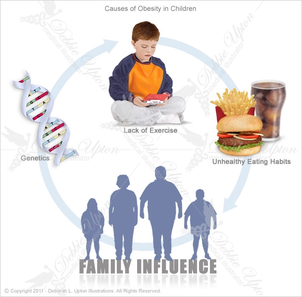 causes of obesity Read about the main cause of obesity – eating too much and moving too little underlying health conditions and taking certain medications can also contribute to. causes of obesity Read about the main cause of obesity – eating too much and moving too little underlying health conditions and taking certain medications can also contribute to.