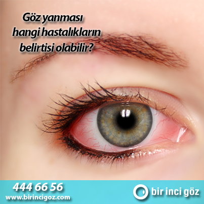 birinci goz goz yanmasi hangi hastaliklarin belirtisi olabilir