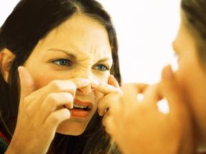 Cara Menghilangkan Komedo Pada Hidung