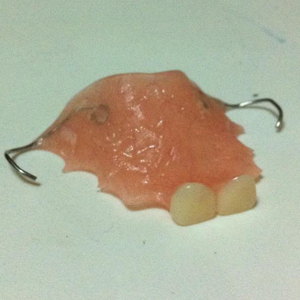 m♥mmil♥ve Space Maintainers with Artificial Teeth