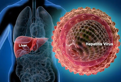 Características de la Hepatitis A