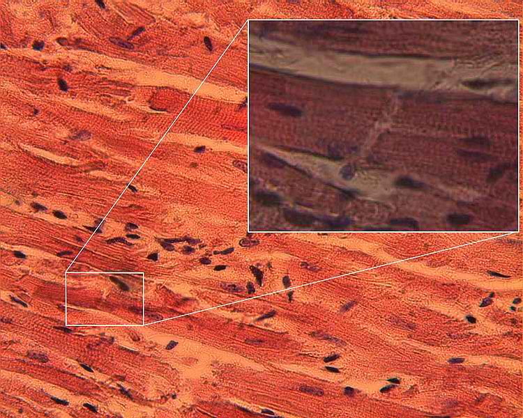 Within my Mind: Muscular System